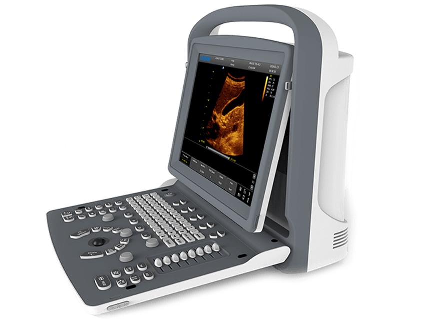 Ultrasonogrāfijas ierīces, CHISON ECO2 B&W ULTRASOUND - 1 probe connector