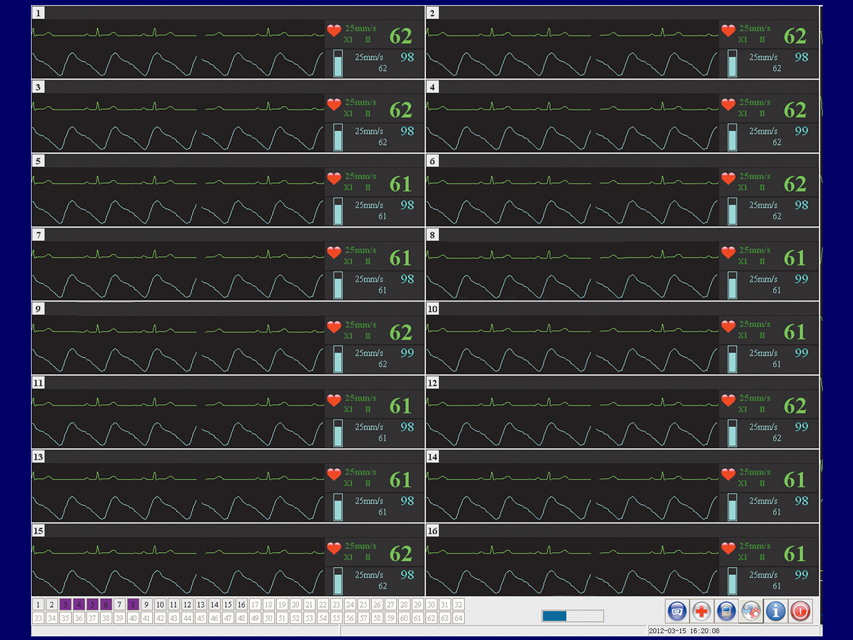 Pacientu monitorings, Centrālās stacijas programmatūra