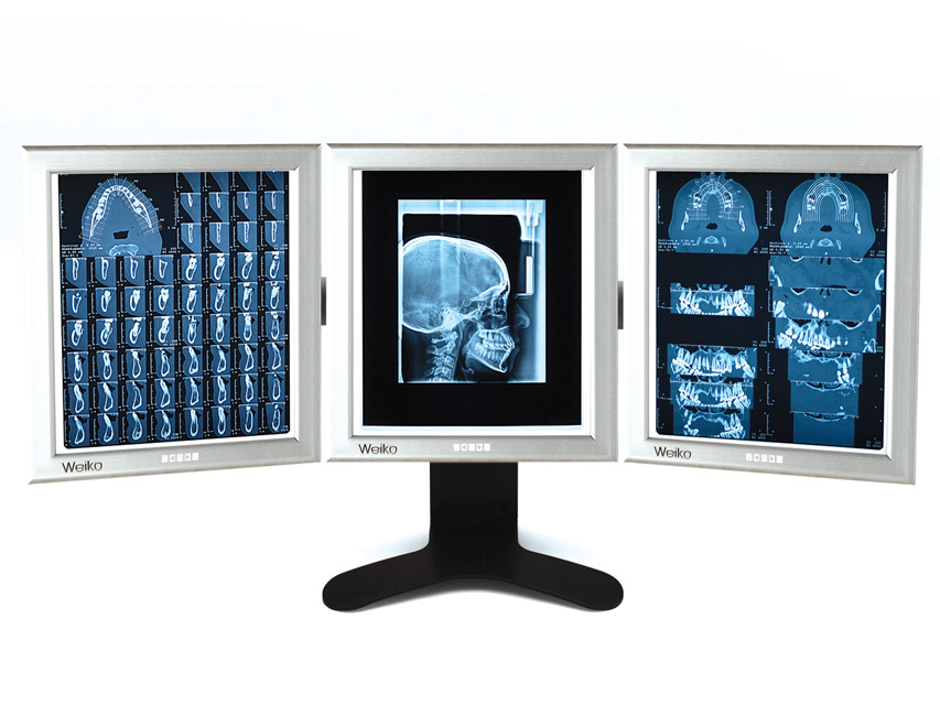 Ierīce rentgenattēlu apskatei, Desktop ultra slim led light box 2