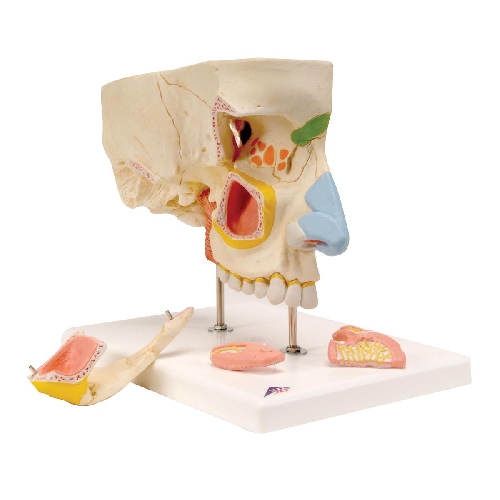 Muguras jostas daļas kanāls ar noslīdējušu sānu skriemeļa disku, Nose Model with Paranasal Sinuses, 5 part