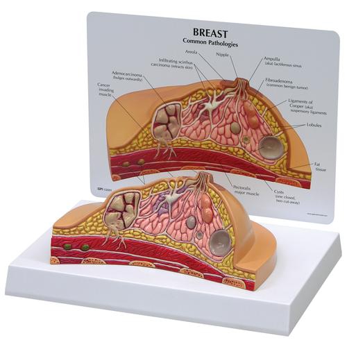 001Breast Cross-Section Model