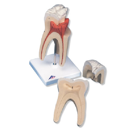 006Upper Triple-Root Molar, 3 part