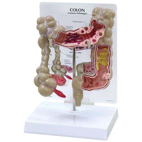 DIGESTIVE SYSTEM MODELS, Colon Model