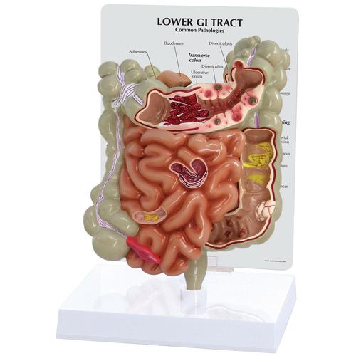 020GI Tract Model