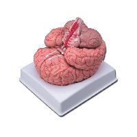 6 BRAIN WITH ARTERIES