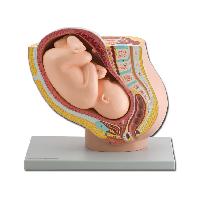 4 PREGNANCY PELVIS WITH MATURE FETUS - 1X