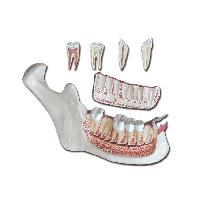 Lower JAW - 6 parts - 3X