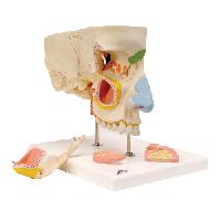 Nose Model with Paranasal Sinuses, 5 part