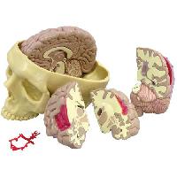 Brain Model 1