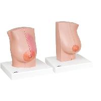 Model of female breast