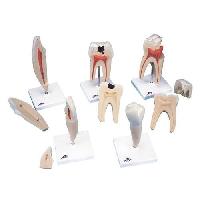 Classic Tooth Model Series, 5 models