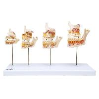 Dentition Development