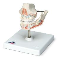 Milk Dentures