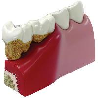 Teeth Model 1
