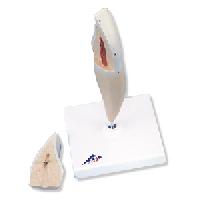 Lower Incisor, 2 part