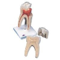 Upper Triple-Root Molar, 3 part