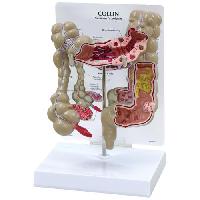 Colon Model