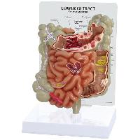 GI Tract Model